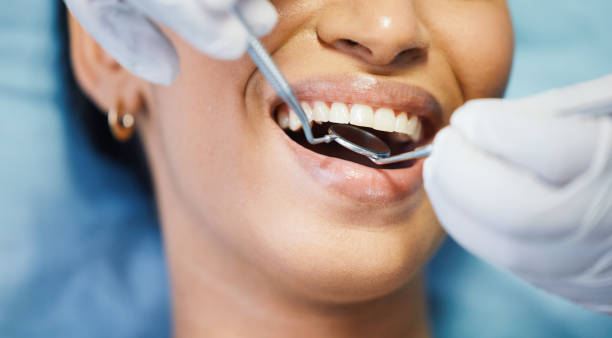 Best Emergency Dentist for Knocked-Out Tooth in Gardner, IL